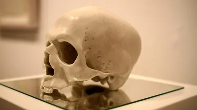 человеческие останки