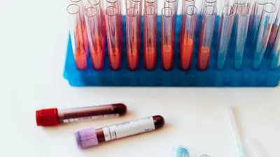 Лаборатория, анализы 