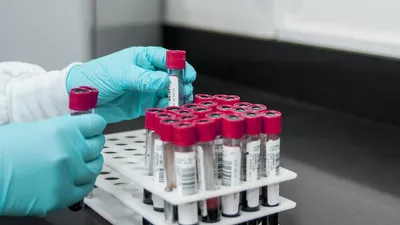 анализы, лаборатория