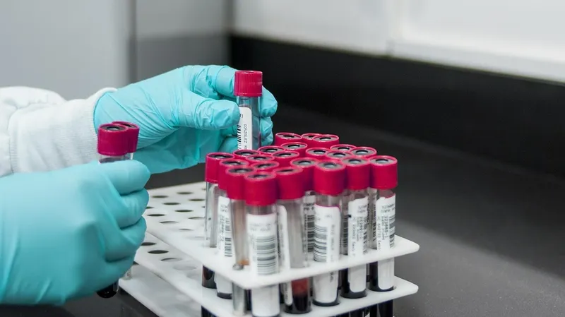 анализы, лаборатория