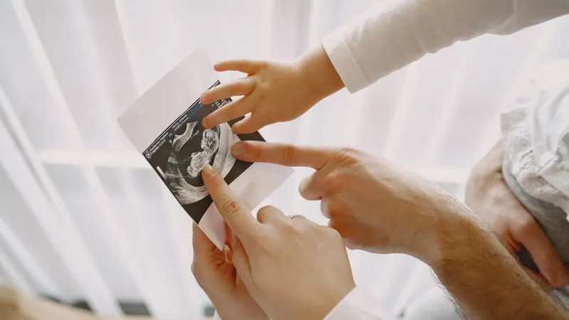 УЗИ, беременность